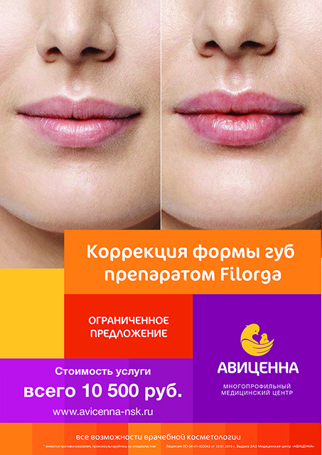 Увеличение губ препаратом филорга Увеличение губ препаратом филорга